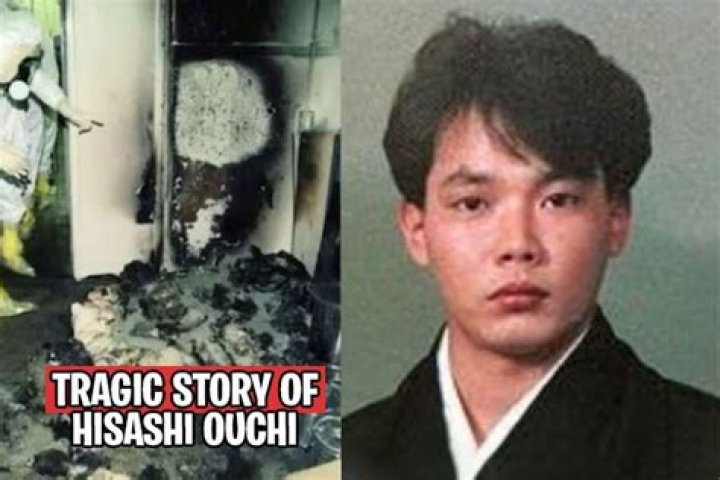 A Look At The Tragic Aftermath: Hisashi Ouchi's Body Photos