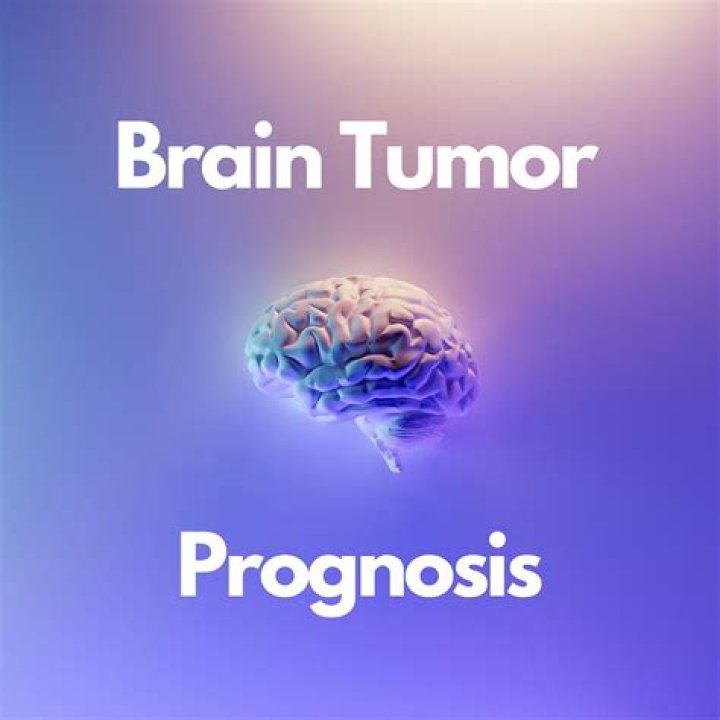Andrea Swift's Brain Tumor: Prognosis For 2024