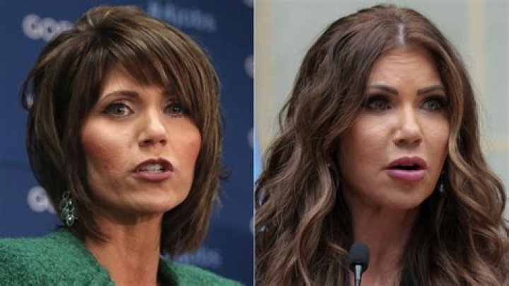 Kristi Noem's Stunning Transformation: Before And After